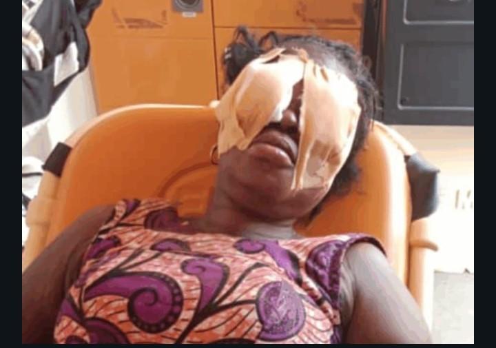 55-Year-Old Man Jailed Five Years for Blinding Sister in Brutal Attack at Sefwi Abrokofe